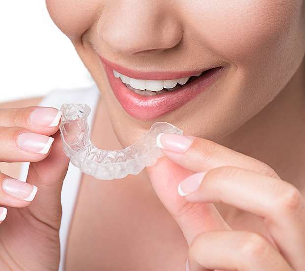 San Jose Clear Aligners
