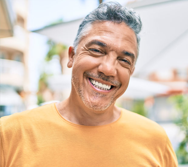 San Jose Dental Crowns and Dental Bridges